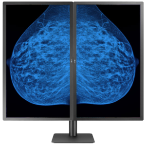 Mammography Monitor