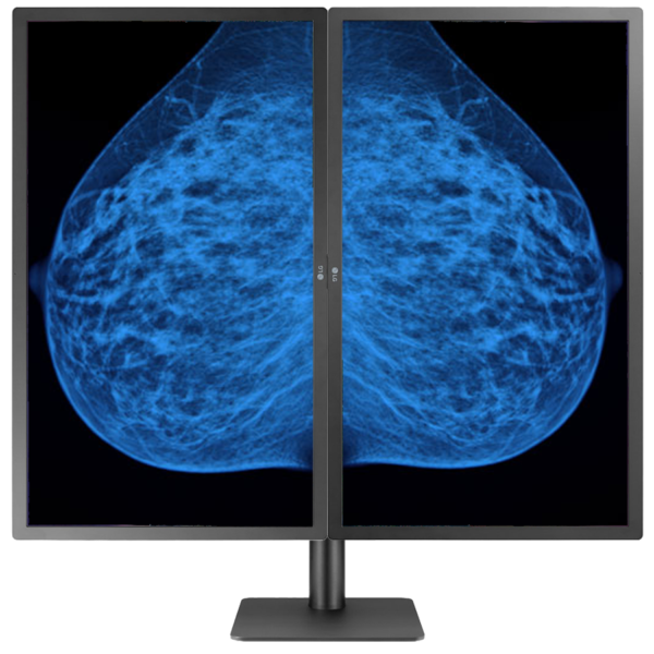 Mammography Monitor