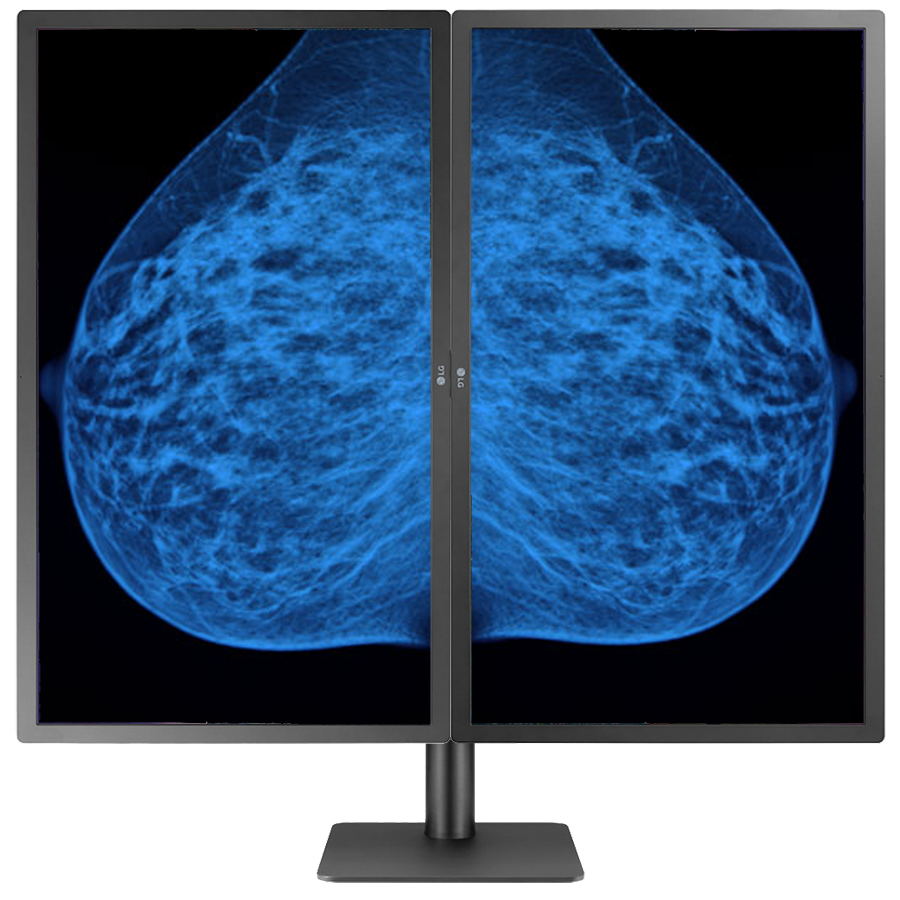 Mammography Monitor